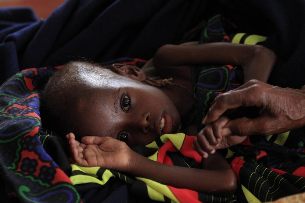 Somalija, suša, Foto: Beta/AP