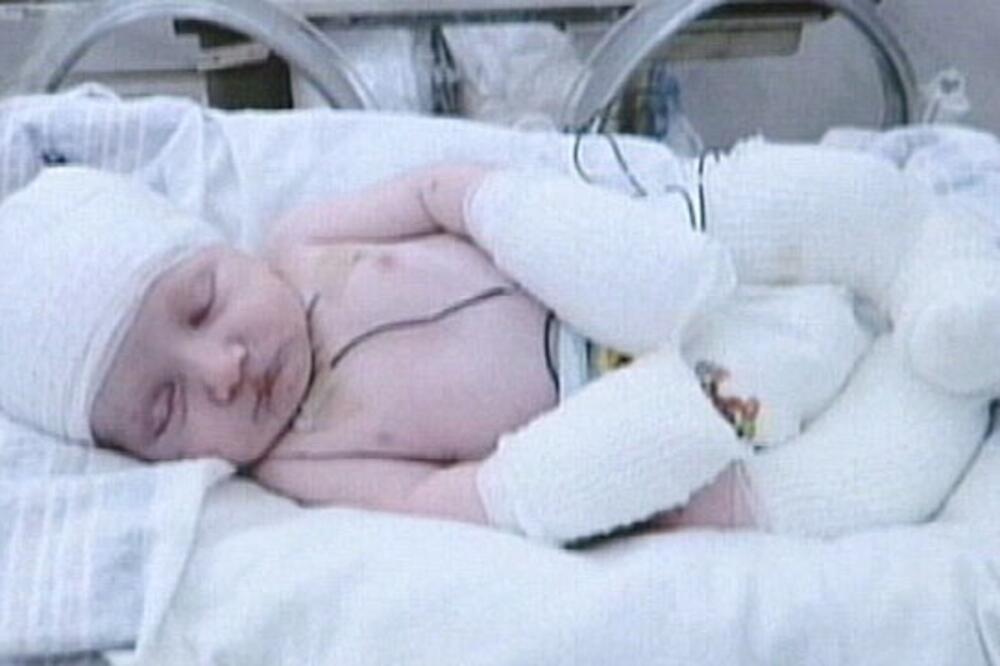 beba, Foto: Www.abcnews.go.com