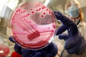 Novu vrstu bakterije ešerihija koli može da prenese i čovjek