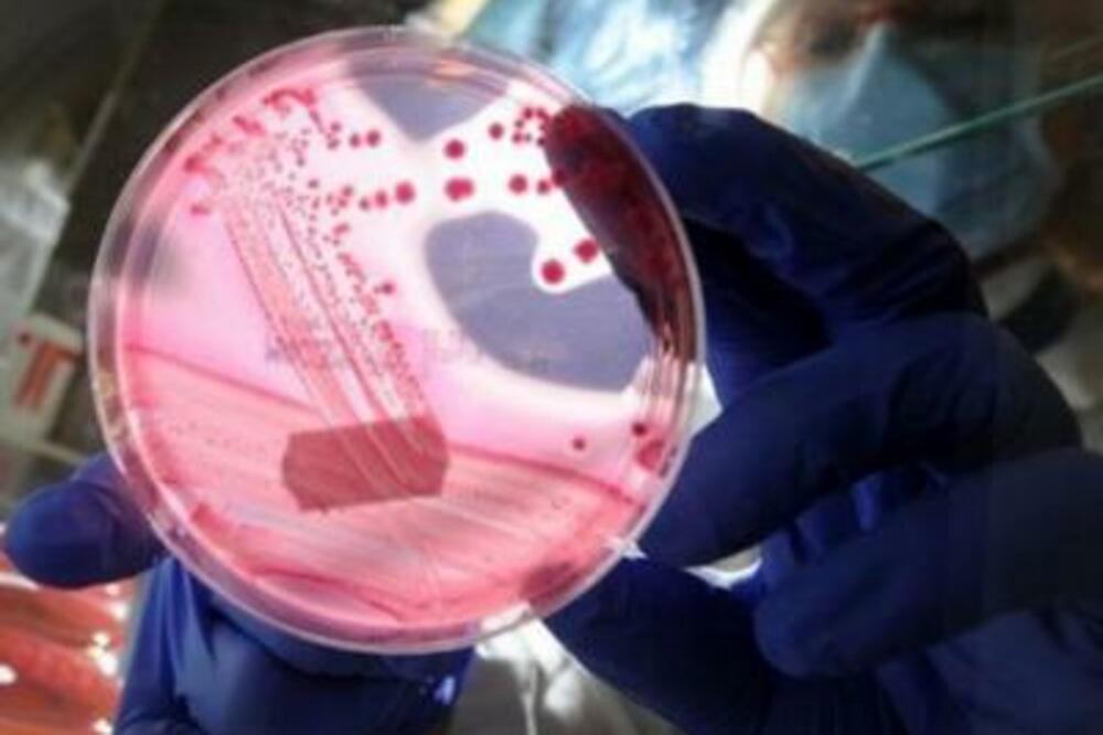 Ešerihija koli, Foto: Smedia.rs