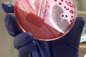 Francuska: Šestoro djece u bolnici zbog ešerihije koli