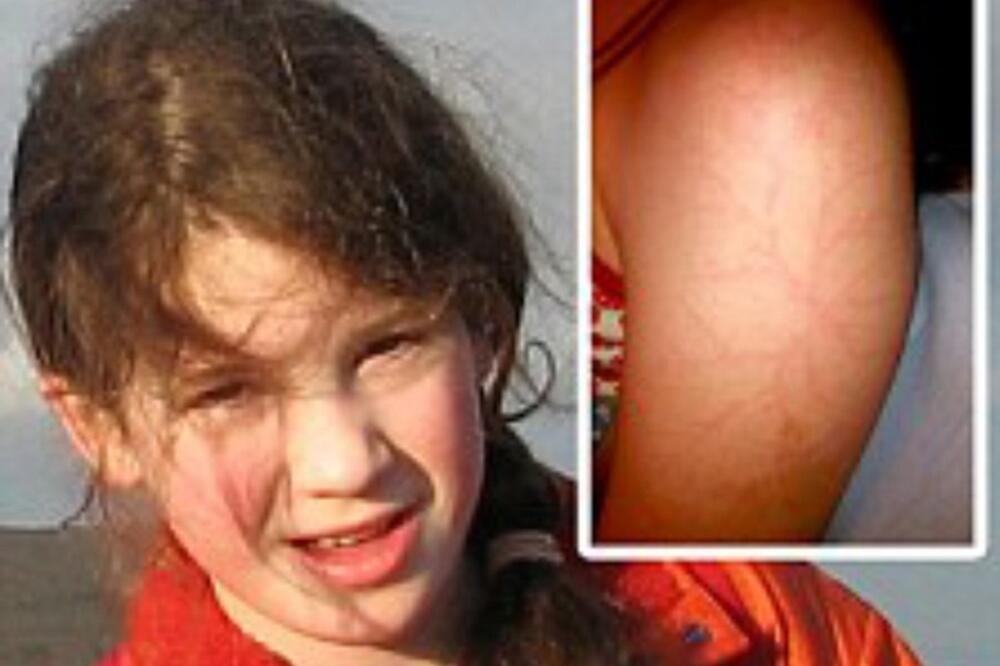 djevojcica, Foto: Dailymail.co.uk