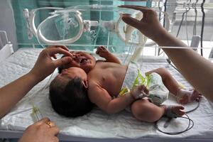 U Kini rođeno dvoglavo dijete
