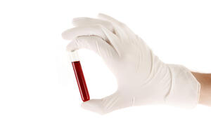 Novi biočip analizira krv za samo nekoliko minuta