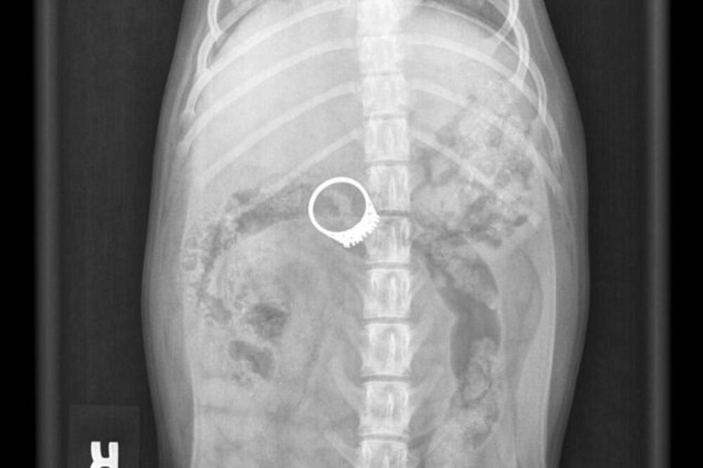 detektor, Foto: Metro