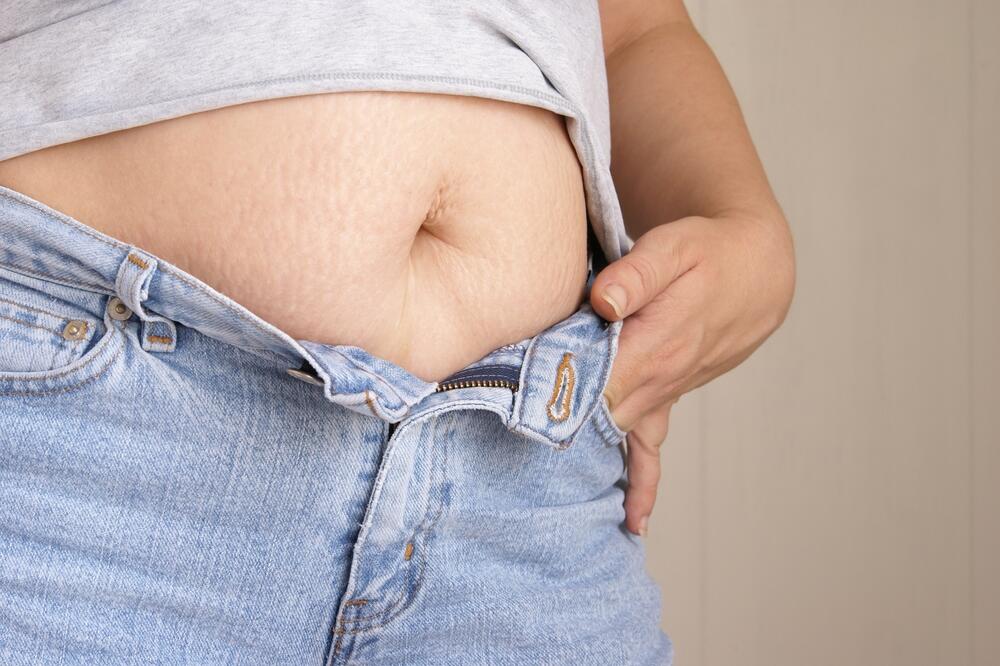 strije, Foto: Www.shutterstock.com