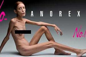 Umrla čuvena manekenka iz reklame protiv anoreksije