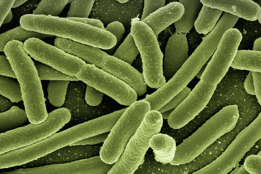 Eschericha coli, Foto: Pixabay