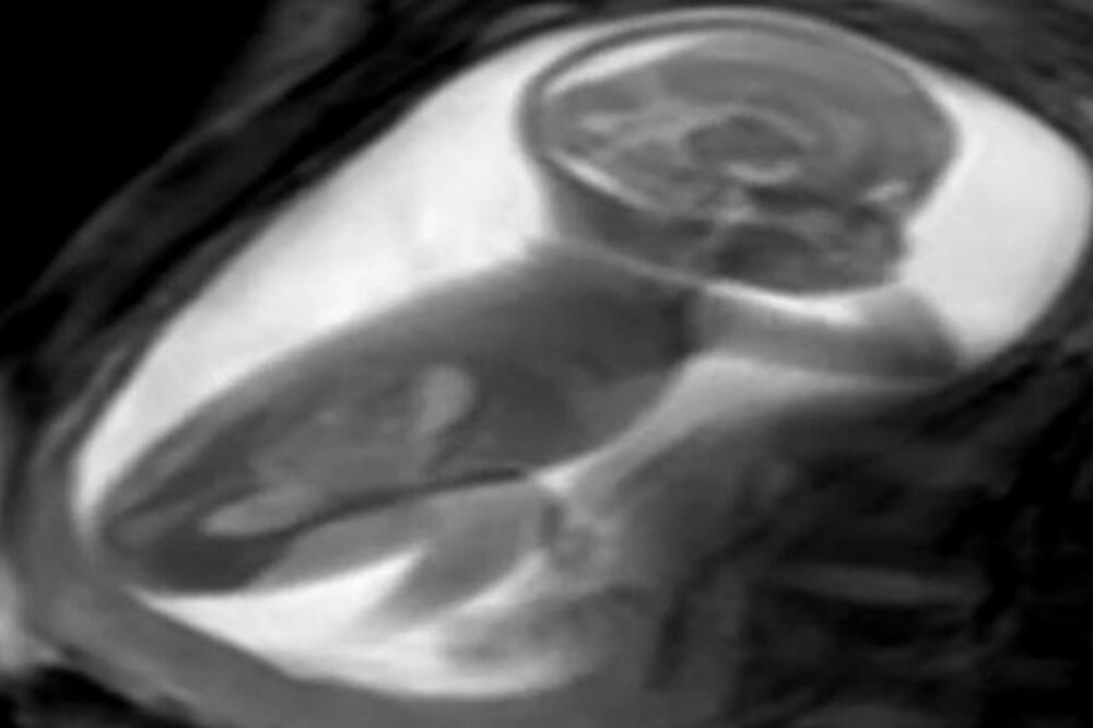 Ilustracija, Foto: BBC