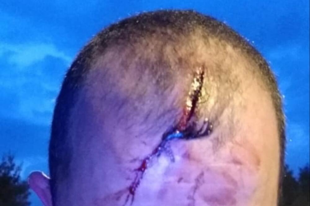 Povreda Aleksandra Ivanovića