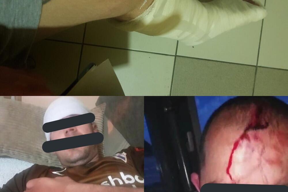 Povrijeđeni navijači "Budućnosti", Foto: Facebook