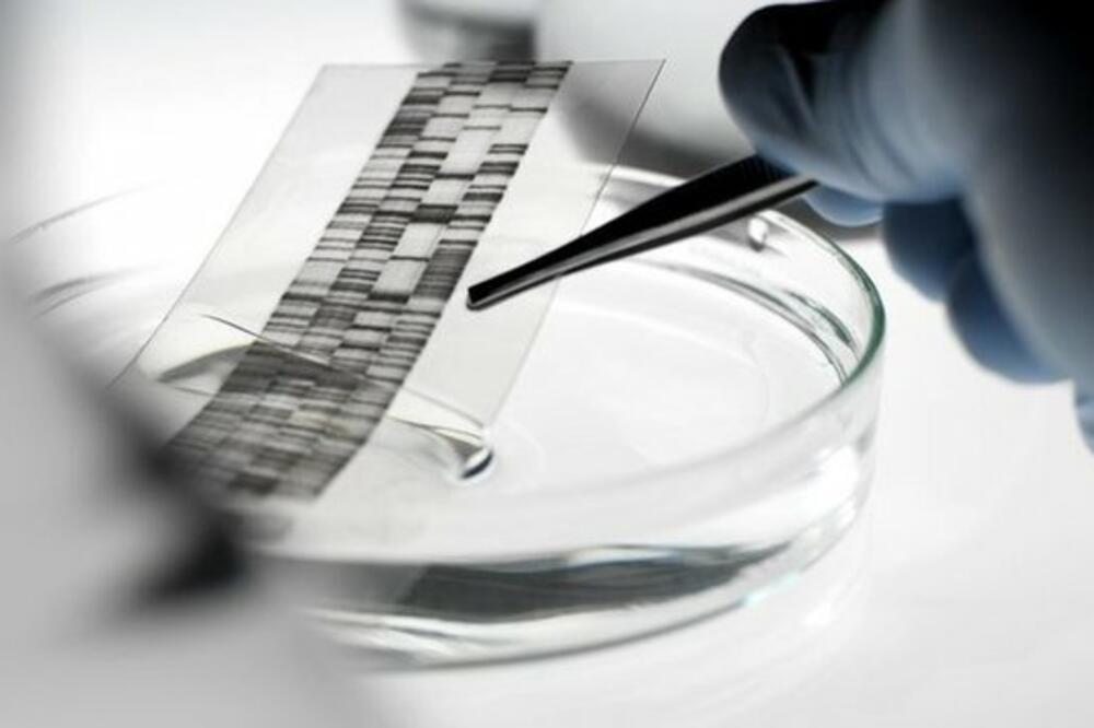 Ni DNK test nije uspeo da odgovori na pitanje koji blizanac je otac, Foto: BBC