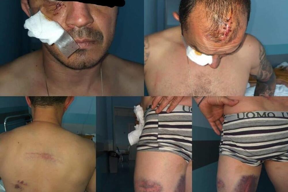 Povrede Varvara, Foto: Arhiva