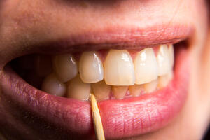 Zbog kojih namirnica naši zubi gube bjelinu i sjaj?