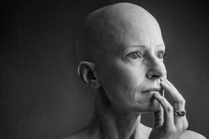 Hirurškinja za rak dojke morala i sama da se uhvati u koštac sa...