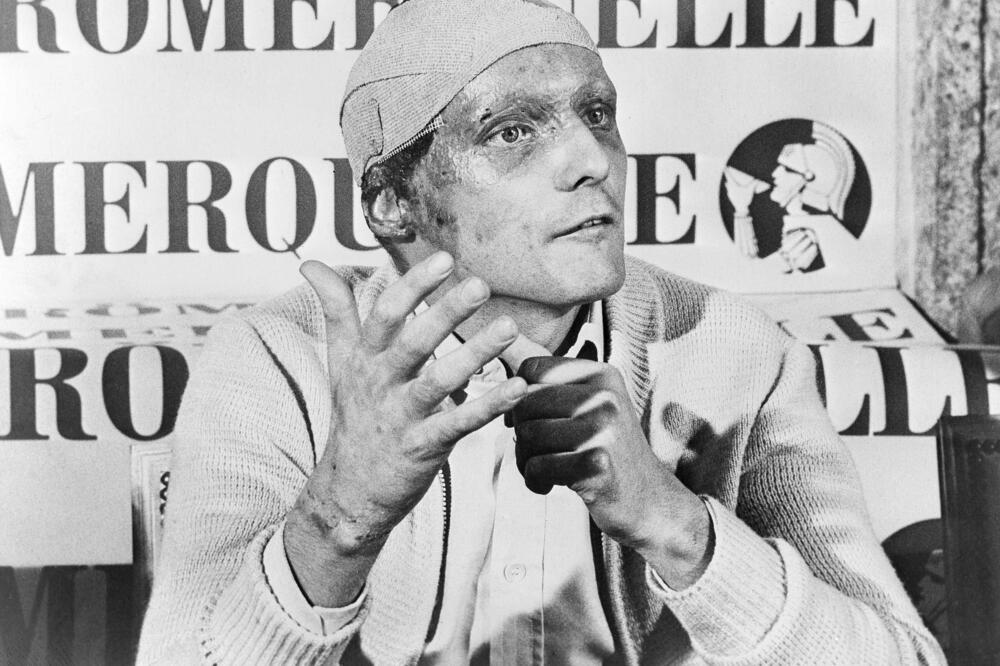 Niki Lauda na trci u Monci, prvoj nakon teških povreda u Hokenhajmu, Foto: AP