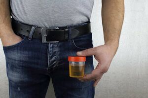 Rak prostate: Novi test uliva nadu