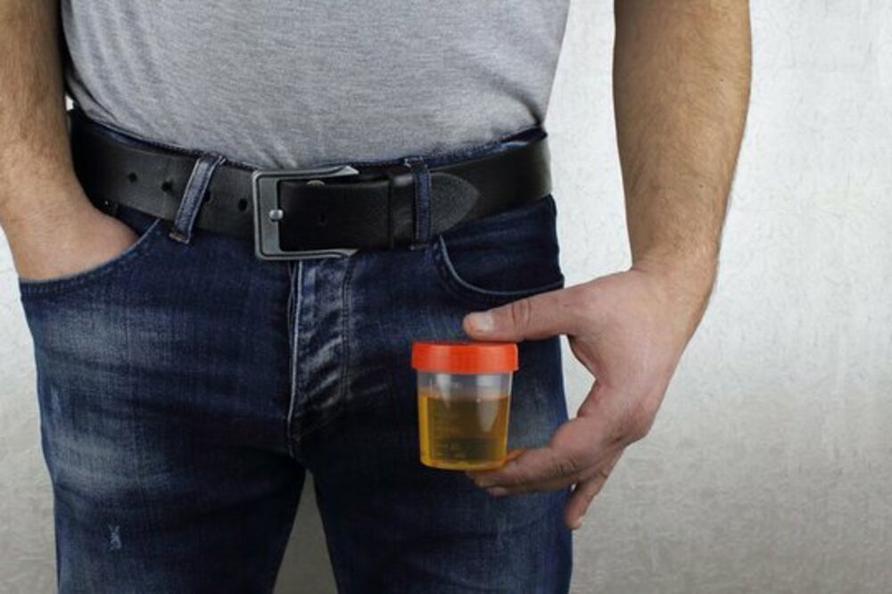 Muškarac drži kutijicu sa uzorkom mokraće, Foto: Getty Images