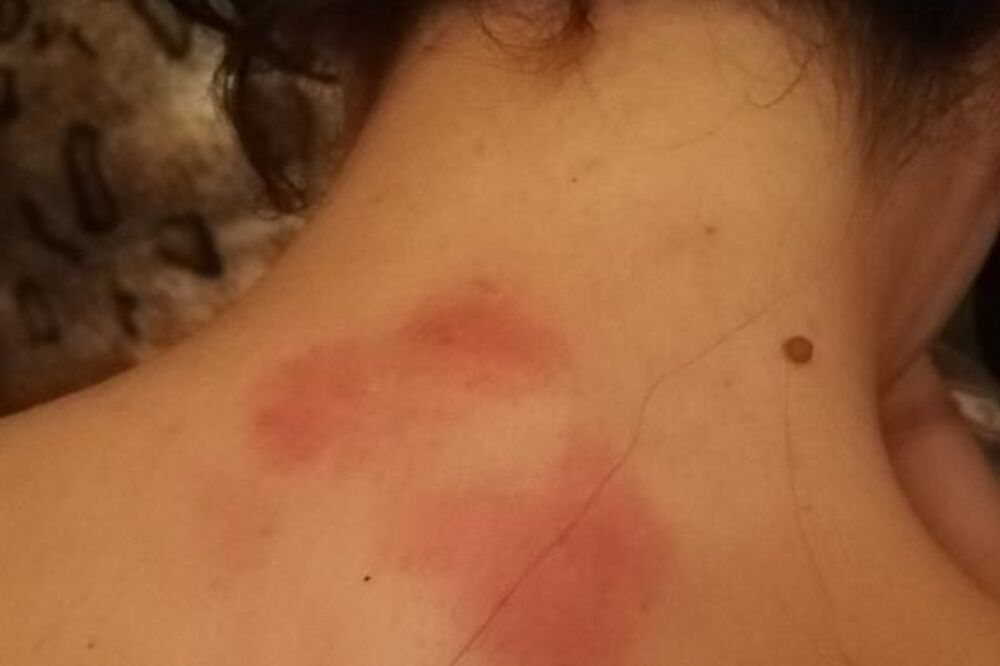 Brutalno pretučena: Sekulićeva, Foto: Privatna arhiva