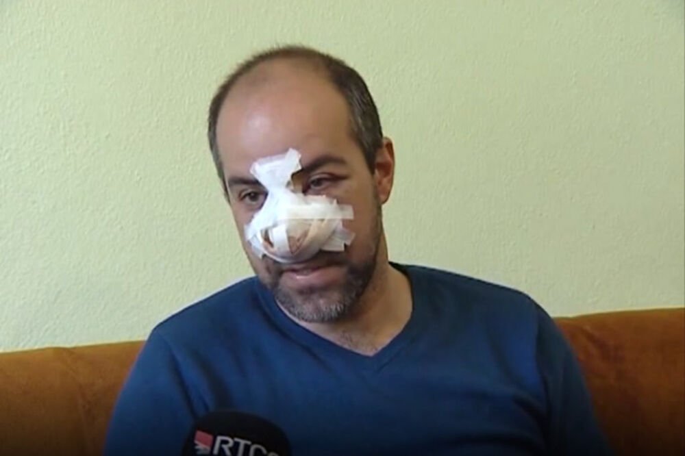 Igor Tomkić nakon prebijanja