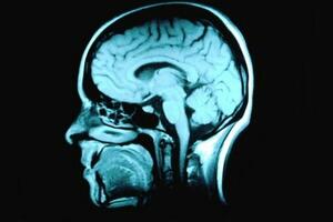Neuronauka: Zašto su istraživanja mozga važna