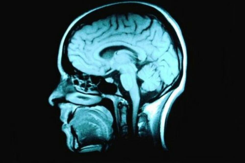 Ilustracija, Foto: BBC