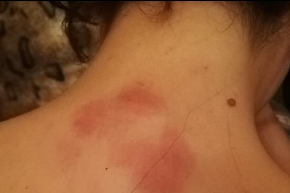 Brutalno pretučena: Sekulićeva, Foto: Privatna arhiva