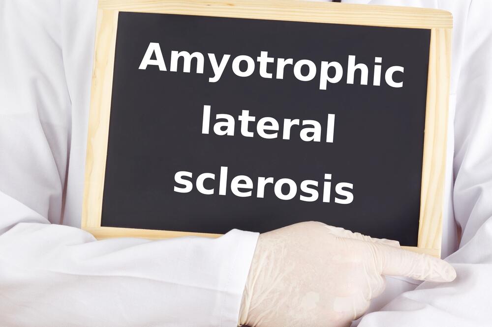 Amiotrofična lateralna skleroza (Ilustracija), Foto: Shutterstock