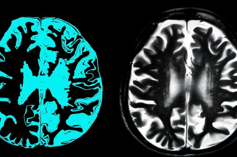 Ilustracija, Foto: Getty Images