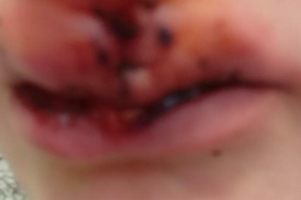 Krstić od utorka u bolnici, Foto: Privatna arhiva