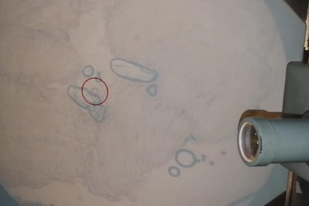 Trihinela, Foto: Printscreen