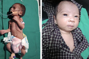 Indija: Prijevremeno rođenu bebu zakopali živu - ona se sad...