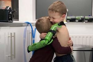 Petogodišnjak dobio „superherojsku" ruku i konačno zagrlio brata