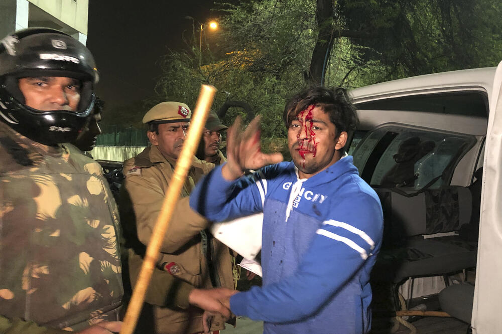 Jedan od povrijeđenih demonstranata, Foto: AP