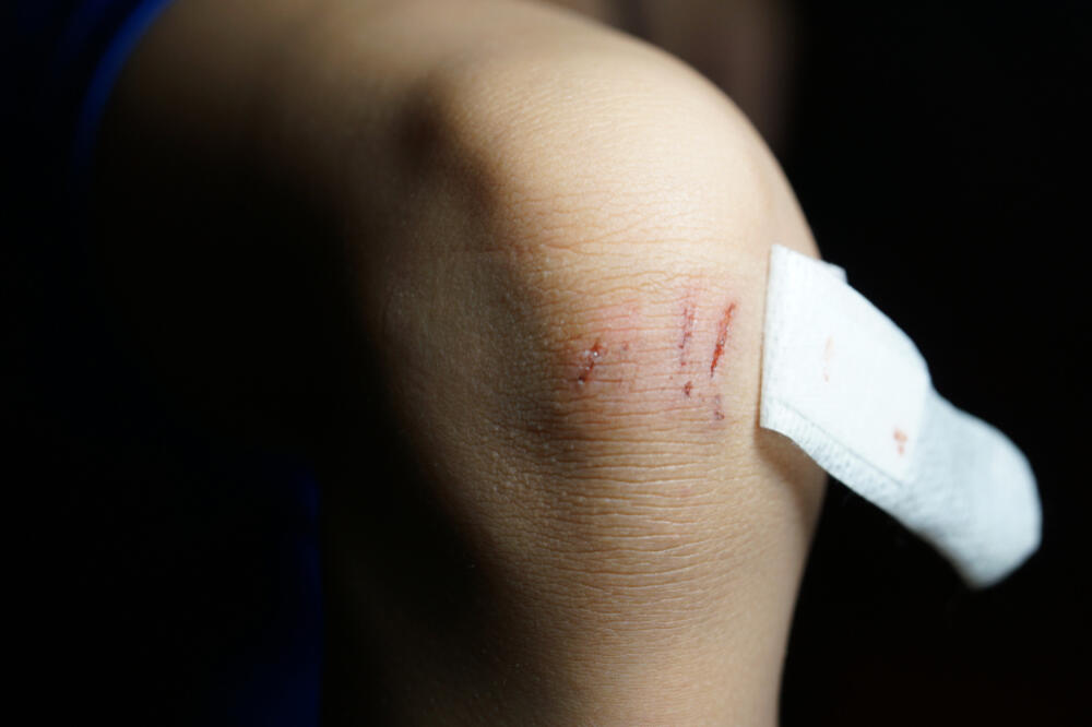 Ilustracija, Foto: Shutterstock