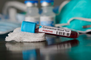 U Norveškoj prvi smrtni slučaj od koronavirusa