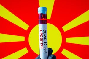 Prva žrtva koronavirusa u Sjevernoj Makedoniji