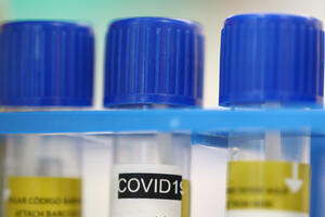 IJZ: Još pet slučajeva zaraze koronavirusom