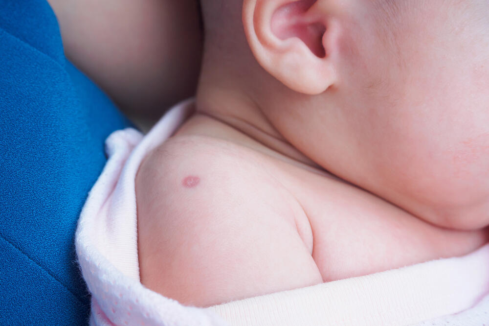Djeca vakcinu BCG uglavnom primaju odmah po rođenju, Foto: Shutterstock