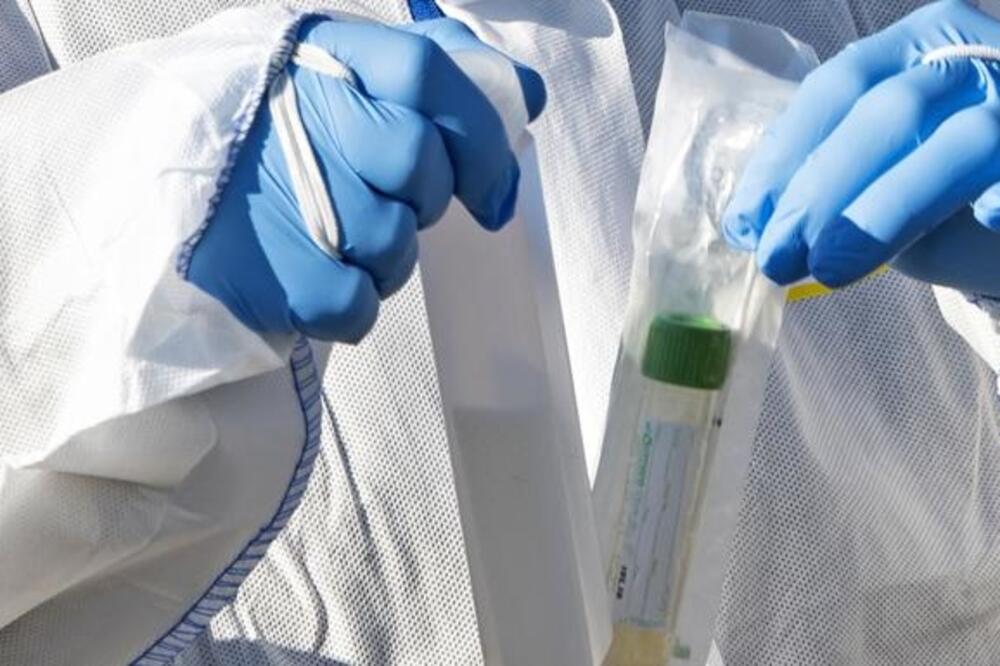 Testovi za koronavirus, Foto: Beta