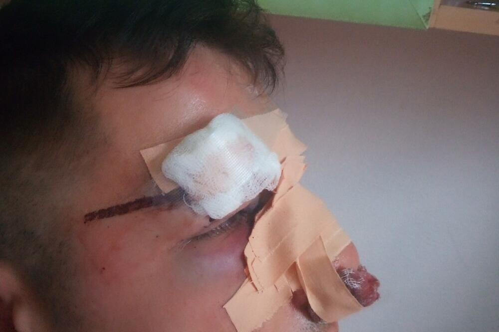 Omerović nakon napada, Foto: Privatna arhiva