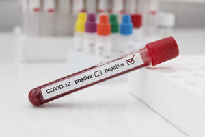 Bez novih potvrđenih slučajeva zaraze koronavirusom, trenutno...