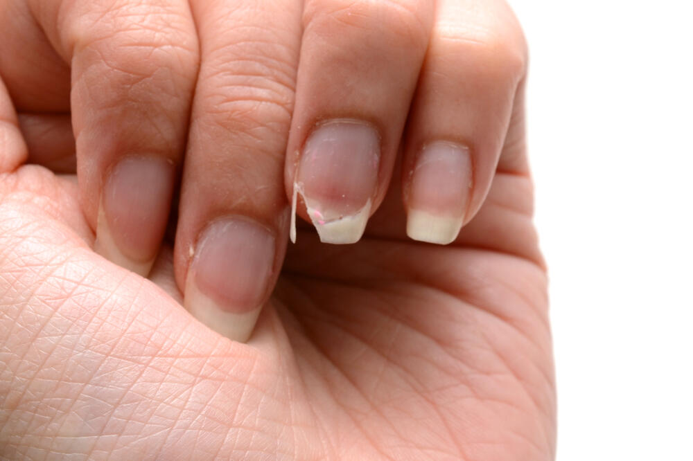 Ilustracija, Foto: Shutterstock