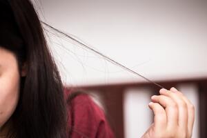 Trihotilomanija - trajno i ponavljano čupanje kose
