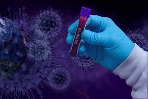 IJZ: Četiri nova slučaja zaraze koronavirusom