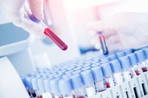 Više od polovine testiranih u Bergamu ima antitijela