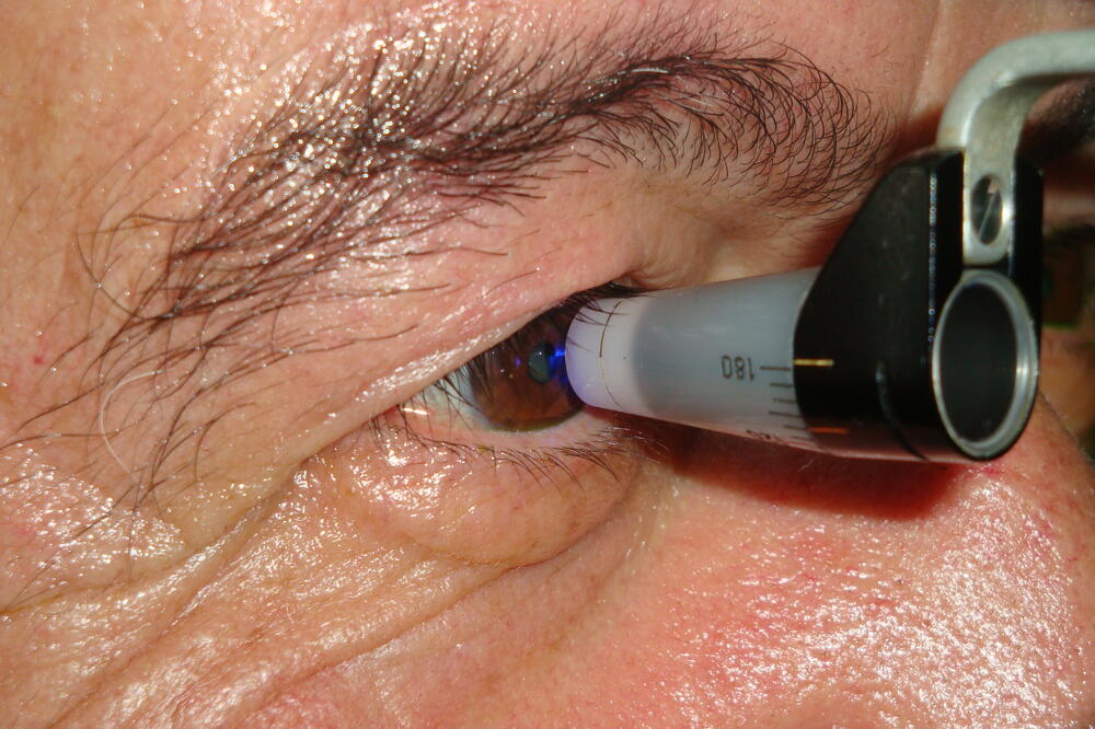 Na pregled se čeka do dvadesetak dana (ilustracija), Foto: Vijesti