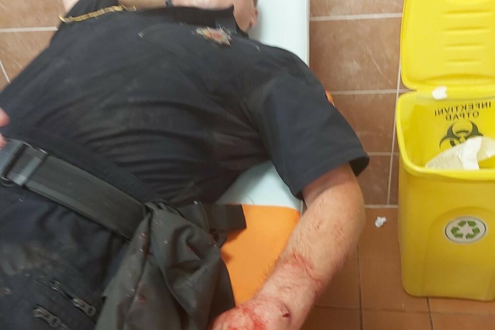 Povrijeđeni policajac, Foto: Uprava policije
