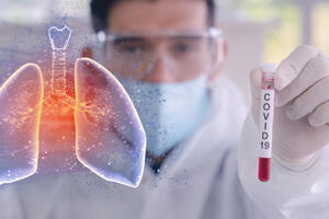 Kovid-19 može promijeniti izgled pluća do neprepoznatljivosti