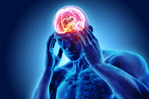 Svaka sedma osoba boluje od migrene